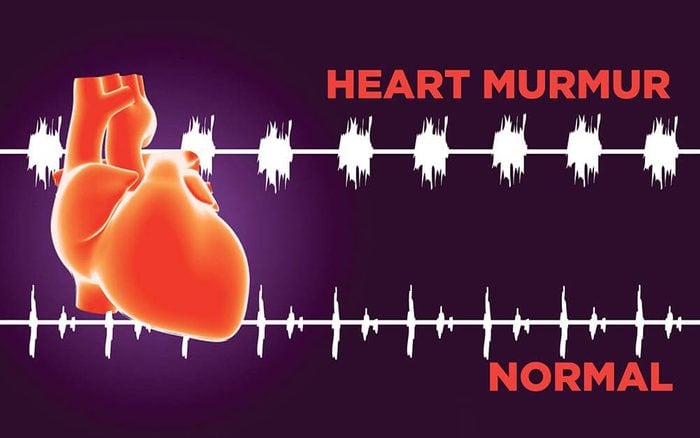 normal heart and heart murmurs